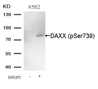 WB analysis of extracts from K562 cells untreated (lane 1) or treated with serum (lane 2) using GTX55302 Daxx (phospho Ser739) antibody. WB analysis of extracts from K562 cells untreated (lane 1) or treated with serum (lane 2) using GTX55302 Daxx (phospho Ser739) antibody.