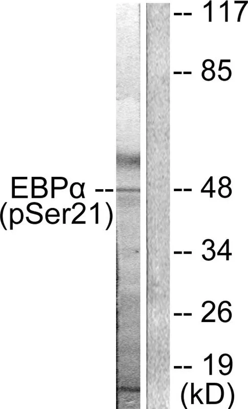 WB analysis of extracts from HepG2 cells treated with EGF using GTX55304 C/EBP alpha (phospho Ser21) antibody. Left : Primary antibody Right : Primary antibody pre-incubated with the antigen specific peptide