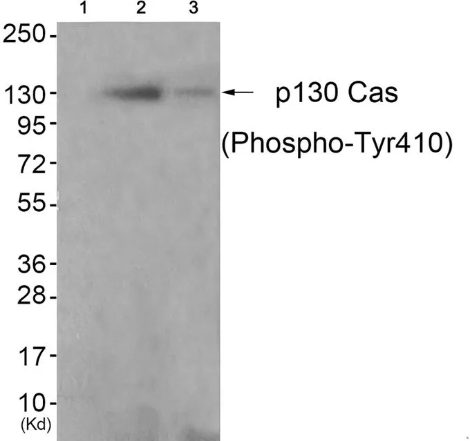 WB analysis of extracts from K562 cells (lane 2) and 3T3 cells (lane 3) using GTX55306 p130Cas (phospho Tyr410) antibody. Left : Primary antibody pre-incubated with the antigen specific peptide Right : Primary antibody