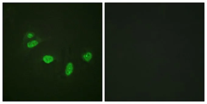 ICC/IF analysis of methanol-fixed HeLa cells using GTX55307 ETS1 (phospho Thr38) antibody. ICC/IF analysis of methanol-fixed HeLa cells using GTX55307 ETS1 (phospho Thr38) antibody.