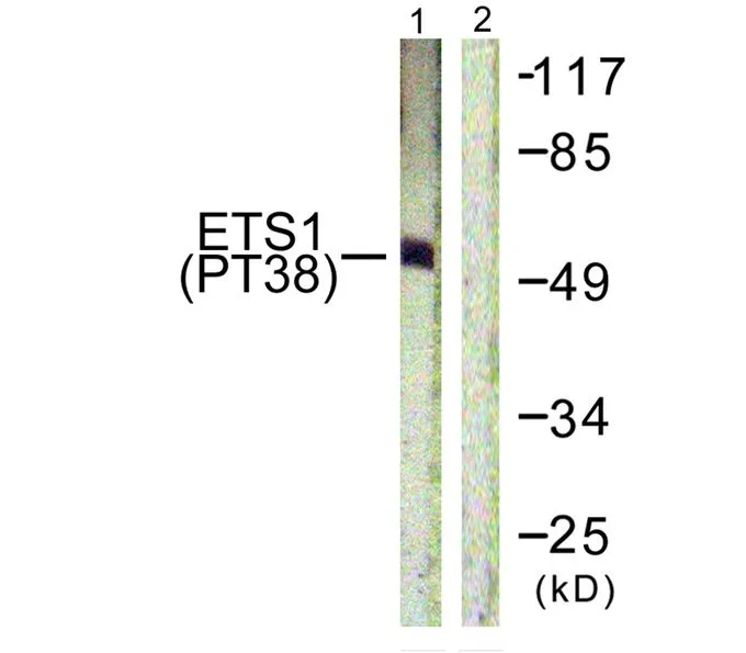 WB analysis of extracts from HepG2 cells using GTX55307 ETS1 (phospho Thr38) antibody. Left : Primary antibody Right : Primary antibody pre-incubated with the antigen specific peptide