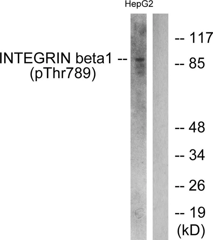 WB analysis of extracts from HepG2 cells treated with Ca2+ using GTX55308 Integrin beta 1 / CD29 (phospho Thr789) antibody. Left : Primary antibody Right : Primary antibody pre-incubated with the antigen specific peptide
