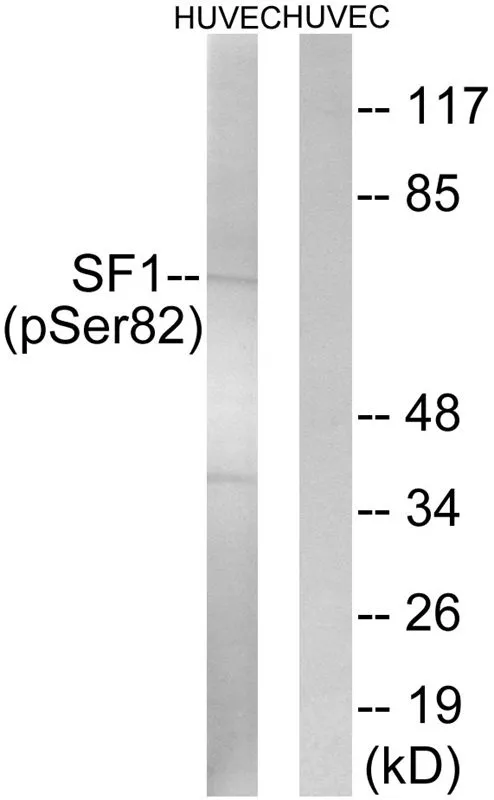 WB analysis of extracts from HUVEC cells treated with anisomycin using GTX55309 Splicing Factor 1 (phospho Ser82) antibody. Left : Primary antibody Right : Primary antibody pre-incubated with the antigen specific peptide