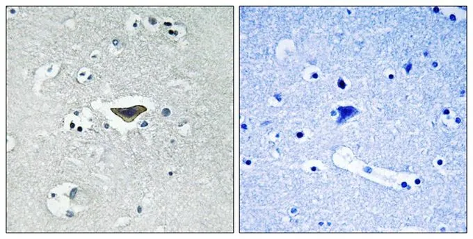 IHC-P analysis of human brain tissue using GTX55312 RASGRF1 (phospho Ser916) antibody. Left : Primary antibody Right : Primary antibody pre-incubated with the antigen specific peptide IHC-P analysis of human brain tissue using GTX55312 RASGRF1 (phospho Ser916) antibody. Left : Primary antibody Right : Primary antibody pre-incubated with the antigen specific peptide