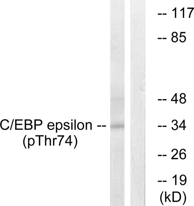 WB analysis of extracts from HUVEC cells treated with UV using GTX55315 C/EBP epsilon (phospho Thr74) antibody. Left : Primary antibody Right : Primary antibody pre-incubated with the antigen specific peptide WB analysis of extracts from HUVEC cells treated with UV using GTX55315 C/EBP epsilon (phospho Thr74) antibody. Left : Primary antibody Right : Primary antibody pre-incubated with the antigen specific peptide