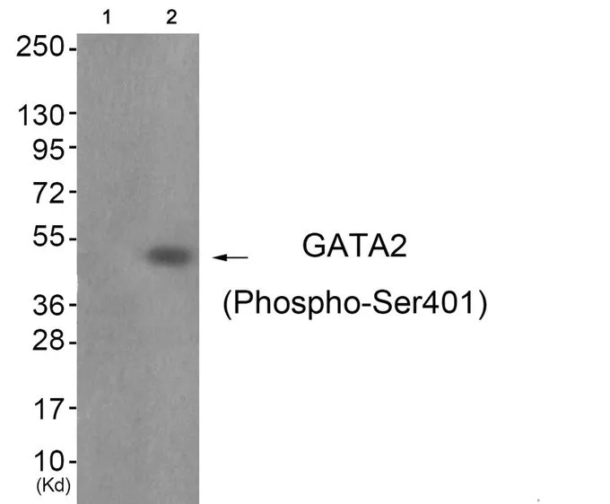 WB analysis of extracts from JK cells (lane 2) using GTX55317 GATA2 (phospho Ser401) antibody. Left : Primary antibody pre-incubated with the antigen specific peptide Right : Primary antibody WB analysis of extracts from JK cells (lane 2) using GTX55317 GATA2 (phospho Ser401) antibody. Left : Primary antibody pre-incubated with the antigen specific peptide Right : Primary antibody