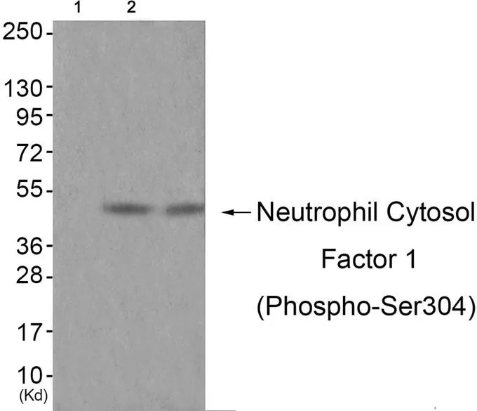 WB analysis of extracts from JK cells (lane 2) and COS-7 cells (lane 3) using GTX55323 NCF1 (phospho Ser304) antibody. Left : Primary antibody pre-incubated with the antigen specific peptide Right : Primary antibody WB analysis of extracts from JK cells (lane 2) and COS-7 cells (lane 3) using GTX55323 NCF1 (phospho Ser304) antibody. Left : Primary antibody pre-incubated with the antigen specific peptide Right : Primary antibody