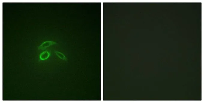ICC/IF analysis of methanol-fixed HepG2 cells using GTX55325 MUC1 (phospho Tyr1229) antibody. ICC/IF analysis of methanol-fixed HepG2 cells using GTX55325 MUC1 (phospho Tyr1229) antibody.