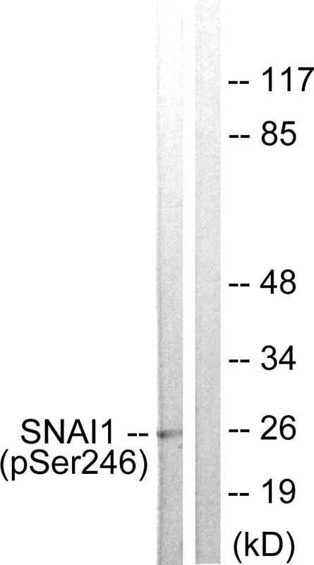 WB analysis of extracts from HT-29 cells using GTX55326 SNAI1 (phospho Ser246) antibody. Left : Primary antibody Right : Primary antibody pre-incubated with the antigen specific peptide