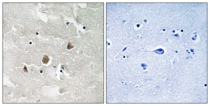 IHC-P analysis of human brain tissue using GTX55333 MAP3K1 (phospho Thr1400) antibody. Left : Primary antibody Right : Primary antibody pre-incubated with the antigen specific peptide IHC-P analysis of human brain tissue using GTX55333 MAP3K1 (phospho Thr1400) antibody. Left : Primary antibody Right : Primary antibody pre-incubated with the antigen specific peptide