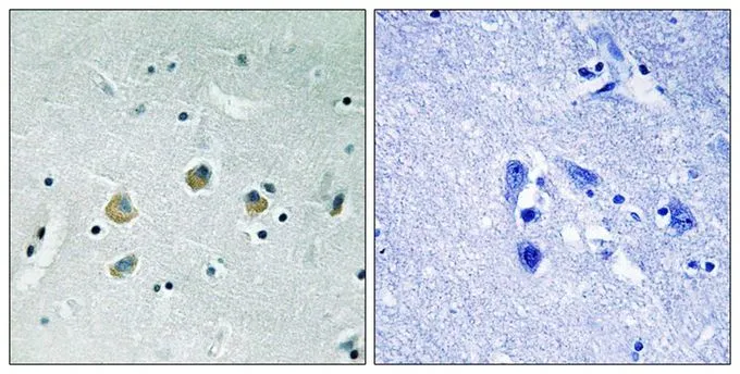 IHC-P analysis of human brain tissue using GTX55334 MAP3K8 (phospho Ser400) antibody. Left : Primary antibody Right : Primary antibody pre-incubated with the antigen specific peptide IHC-P analysis of human brain tissue using GTX55334 MAP3K8 (phospho Ser400) antibody. Left : Primary antibody Right : Primary antibody pre-incubated with the antigen specific peptide