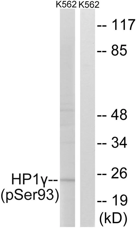 WB analysis of extracts from K562 cells treated with forskolin using GTX55339 HP1 gamma (phospho Ser93) antibody. Left : Primary antibody Right : Primary antibody pre-incubated with the antigen specific peptide WB analysis of extracts from K562 cells treated with forskolin using GTX55339 HP1 gamma (phospho Ser93) antibody. Left : Primary antibody Right : Primary antibody pre-incubated with the antigen specific peptide