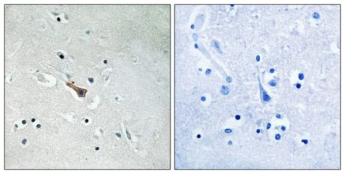 IHC-P analysis of human brain tissue using GTX55348 APLP2 (phospho Tyr755) antibody. Left : Primary antibody Right : Primary antibody pre-incubated with the antigen specific peptide IHC-P analysis of human brain tissue using GTX55348 APLP2 (phospho Tyr755) antibody. Left : Primary antibody Right : Primary antibody pre-incubated with the antigen specific peptide
