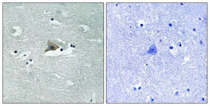 IHC-P analysis of human brain tissue using GTX55352 Claudin 5 (phospho Tyr217) antibody. Left : Primary antibody Right : Primary antibody pre-incubated with the antigen specific peptide IHC-P analysis of human brain tissue using GTX55352 Claudin 5 (phospho Tyr217) antibody. Left : Primary antibody Right : Primary antibody pre-incubated with the antigen specific peptide
