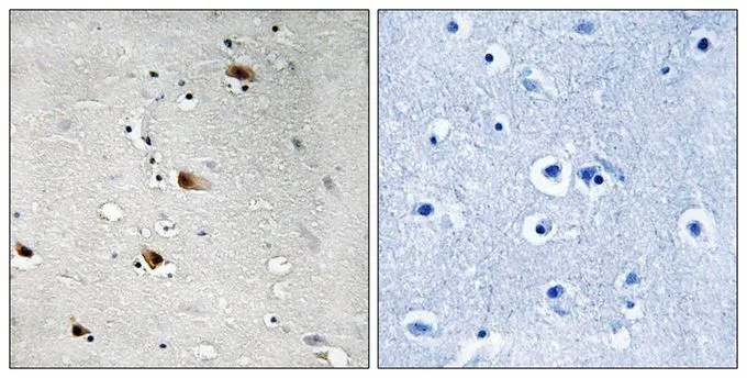 IHC-P analysis of human brain tissue using GTX55358 TCF3 / E2A (phospho Thr355) antibody. Left : Primary antibody Right : Primary antibody pre-incubated with the antigen specific peptide IHC-P analysis of human brain tissue using GTX55358 TCF3 / E2A (phospho Thr355) antibody. Left : Primary antibody Right : Primary antibody pre-incubated with the antigen specific peptide