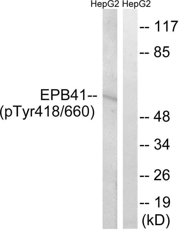 WB analysis of extracts from HepG2 cells treated with PMA using GTX55359 EPB41 (phospho Tyr660/418) antibody. Left : Primary antibody Right : Primary antibody pre-incubated with the antigen specific peptide WB analysis of extracts from HepG2 cells treated with PMA using GTX55359 EPB41 (phospho Tyr660/418) antibody. Left : Primary antibody Right : Primary antibody pre-incubated with the antigen specific peptide