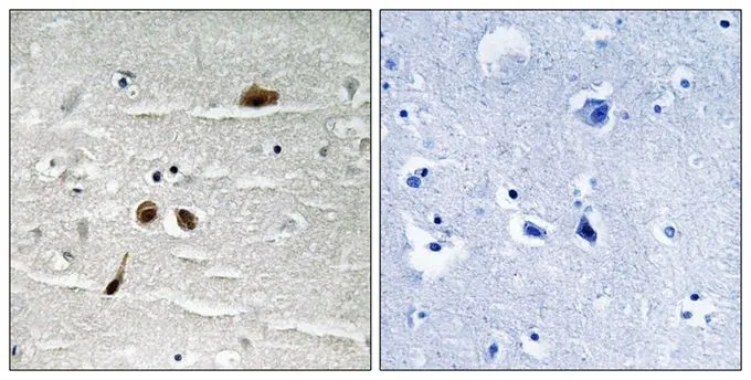IHC-P analysis of human brain tissue using GTX55364 MDC1 (phospho Ser513) antibody. Left : Primary antibody Right : Primary antibody pre-incubated with the antigen specific peptide IHC-P analysis of human brain tissue using GTX55364 MDC1 (phospho Ser513) antibody. Left : Primary antibody Right : Primary antibody pre-incubated with the antigen specific peptide