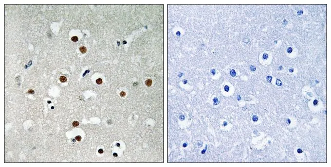IHC-P analysis of human brain tissue using GTX55365 MEF2C (phospho Ser396) antibody. Left : Primary antibody Right : Primary antibody pre-incubated with the antigen specific peptide IHC-P analysis of human brain tissue using GTX55365 MEF2C (phospho Ser396) antibody. Left : Primary antibody Right : Primary antibody pre-incubated with the antigen specific peptide