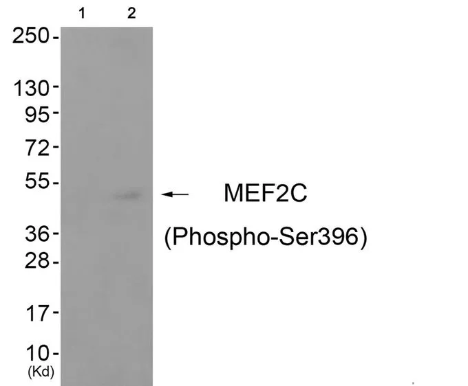 WB analysis of extracts from COS-7 cells (lane 2) using GTX55365 MEF2C (phospho Ser396) antibody. Left : Primary antibody pre-incubated with the antigen specific peptide Right : Primary antibody