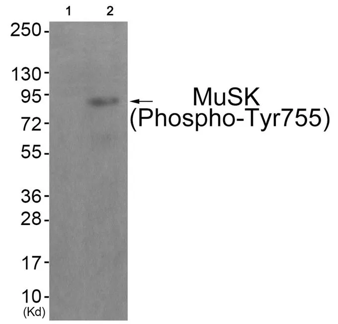WB analysis of extracts from JK cells (lane 2) using GTX55379 MUSK (phospho Tyr755) antibody. Left : Primary antibody pre-incubated with the antigen specific peptide Right : Primary antibody WB analysis of extracts from JK cells (lane 2) using GTX55379 MUSK (phospho Tyr755) antibody. Left : Primary antibody pre-incubated with the antigen specific peptide Right : Primary antibody
