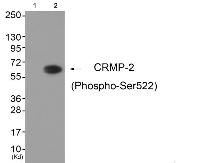WB analysis of extracts from HUVEC cells (lane 2) using GTX55382 CRMP2 (phospho Ser522) antibody. Left : Primary antibody pre-incubated with the antigen specific peptide Right : Primary antibody WB analysis of extracts from HUVEC cells (lane 2) using GTX55382 CRMP2 (phospho Ser522) antibody. Left : Primary antibody pre-incubated with the antigen specific peptide Right : Primary antibody