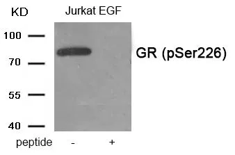 WB analysis of extracts from Jurkat cells treated with EGF using GTX55389 Glucocorticoid Receptor (phospho Ser226) antibody. Left : Primary antibody Right : Primary antibody pre-incubated with the antigen specific peptide WB analysis of extracts from Jurkat cells treated with EGF using GTX55389 Glucocorticoid Receptor (phospho Ser226) antibody. Left : Primary antibody Right : Primary antibody pre-incubated with the antigen specific peptide