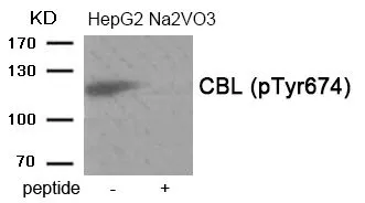 WB analysis of extracts from HepG2 cells treated with Na2VO3 using GTX55390 CBL (phospho Tyr674) antibody. Left : Primary antibody Right : Primary antibody pre-incubated with the antigen specific peptide WB analysis of extracts from HepG2 cells treated with Na2VO3 using GTX55390 CBL (phospho Tyr674) antibody. Left : Primary antibody Right : Primary antibody pre-incubated with the antigen specific peptide