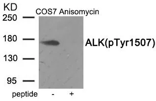 WB analysis of extracts from COS-7 cells treated with Anisomycin using GTX55395 ALK (phospho Tyr1507) antibody. Left : Primary antibody Right : Primary antibody pre-incubated with the antigen specific peptide WB analysis of extracts from COS-7 cells treated with Anisomycin using GTX55395 ALK (phospho Tyr1507) antibody. Left : Primary antibody Right : Primary antibody pre-incubated with the antigen specific peptide