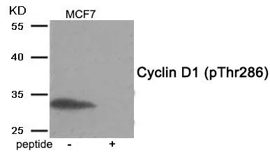 WB analysis of extracts from MCF-7 cells using GTX55397 Cyclin D1 (phospho Thr286) antibody. Left : Primary antibody Right : Primary antibody pre-incubated with the antigen specific peptide WB analysis of extracts from MCF-7 cells using GTX55397 Cyclin D1 (phospho Thr286) antibody. Left : Primary antibody Right : Primary antibody pre-incubated with the antigen specific peptide