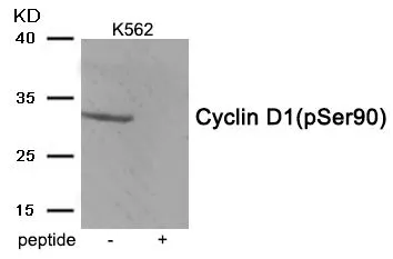WB analysis of extracts from K562 cells using GTX55405 Cyclin D1 (phospho Ser90) antibody. Left : Primary antibody Right : Primary antibody pre-incubated with the antigen specific peptide WB analysis of extracts from K562 cells using GTX55405 Cyclin D1 (phospho Ser90) antibody. Left : Primary antibody Right : Primary antibody pre-incubated with the antigen specific peptide