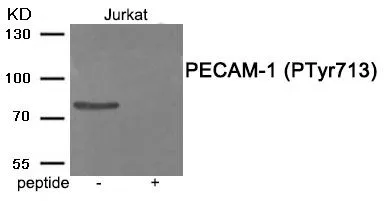 WB analysis of extracts from Jurkat cells using GTX55406 CD31 (phospho Tyr713) antibody. Left : Primary antibody Right : Primary antibody pre-incubated with the antigen specific peptide WB analysis of extracts from Jurkat cells using GTX55406 CD31 (phospho Tyr713) antibody. Left : Primary antibody Right : Primary antibody pre-incubated with the antigen specific peptide