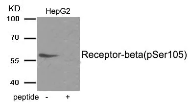 WB analysis of extracts from HepG2 tissue using GTX55407 Estrogen Receptor beta (phospho Ser105) antibody. Left : Primary antibody Right : Primary antibody pre-incubated with the antigen specific peptide WB analysis of extracts from HepG2 tissue using GTX55407 Estrogen Receptor beta (phospho Ser105) antibody. Left : Primary antibody Right : Primary antibody pre-incubated with the antigen specific peptide