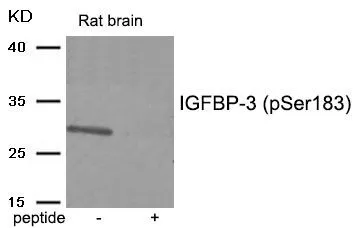 WB analysis of extracts from rat brain tissue using GTX55408 IGFBP3 (phospho Ser183) antibody. Left : Primary antibody Right : Primary antibody pre-incubated with the antigen specific peptide WB analysis of extracts from rat brain tissue using GTX55408 IGFBP3 (phospho Ser183) antibody. Left : Primary antibody Right : Primary antibody pre-incubated with the antigen specific peptide