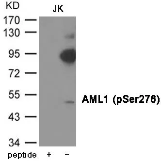 WB analysis of extracts from JK cells using GTX55409 RUNX1 (phospho Ser276) antibody. Left : Primary antibody pre-incubated with the antigen specific peptide Right : Primary antibody WB analysis of extracts from JK cells using GTX55409 RUNX1 (phospho Ser276) antibody. Left : Primary antibody pre-incubated with the antigen specific peptide Right : Primary antibody