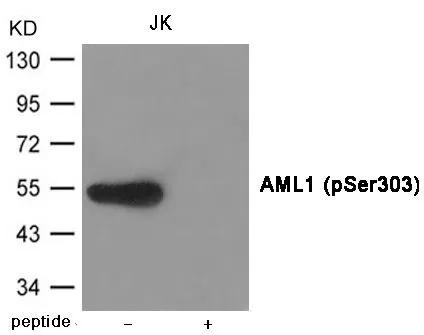WB analysis of extracts from JK cells using GTX55410 RUNX1 (phospho Ser303) antibody. Left : Primary antibody Right : Primary antibody pre-incubated with the antigen specific peptide WB analysis of extracts from JK cells using GTX55410 RUNX1 (phospho Ser303) antibody. Left : Primary antibody Right : Primary antibody pre-incubated with the antigen specific peptide