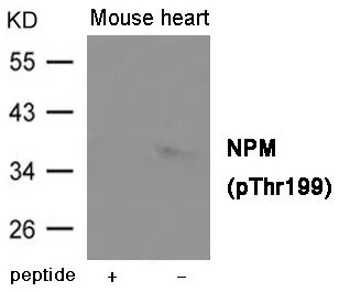 WB analysis of extracts from mouse heart tissue using GTX55419 Nucleophosmin (phospho Thr199) antibody. Left : Primary antibody pre-incubated with the antigen specific peptide Right : Primary antibody WB analysis of extracts from mouse heart tissue using GTX55419 Nucleophosmin (phospho Thr199) antibody. Left : Primary antibody pre-incubated with the antigen specific peptide Right : Primary antibody