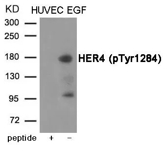 WB analysis of extracts from HUVEC cells treated with EGF using GTX55426 Her4 / ErbB4 (phospho Tyr1284) antibody. Left : Primary antibody pre-incubated with the antigen specific peptide Right : Primary antibody WB analysis of extracts from HUVEC cells treated with EGF using GTX55426 Her4 / ErbB4 (phospho Tyr1284) antibody. Left : Primary antibody pre-incubated with the antigen specific peptide Right : Primary antibody