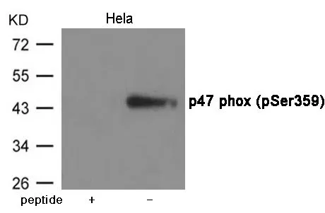 WB analysis of extracts from HeLa cells using GTX55429 NCF1 (phospho Ser359) antibody. Left : Primary antibody pre-incubated with the antigen specific peptide Right : Primary antibody