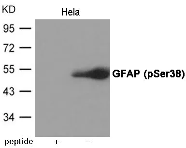 WB analysis of extracts from HeLa cells using GTX55430 GFAP (phospho Ser38) antibody. Left : Primary antibody pre-incubated with the antigen specific peptide Right : Primary antibody WB analysis of extracts from HeLa cells using GTX55430 GFAP (phospho Ser38) antibody. Left : Primary antibody pre-incubated with the antigen specific peptide Right : Primary antibody
