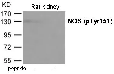 WB analysis of extracts from rat kindey using GTX55433 iNOS (phospho Tyr151) antibody. Left : Primary antibody Right : Primary antibody pre-incubated with the antigen specific peptide