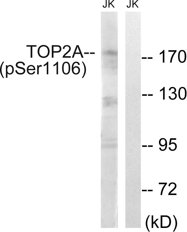 WB analysis of extracts from Jurkat cells treated with paclitaxel (1uM 24 hours) using GTX55437 Topoisomerase II alpha (phospho Ser1106) antibody. Left : Primary antibody Right : Primary antibody pre-incubated with the antigen specific peptide