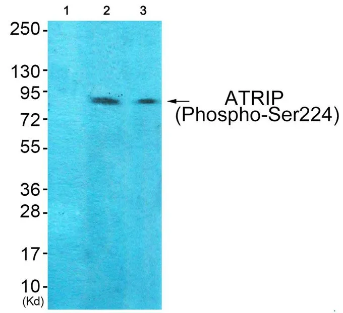 WB analysis of extracts from 293 cells (lane 2) and HeLa cells (lane 3) using GTX55441 ATRIP (phospho Ser224) antibody. Left : Primary antibody pre-incubated with the antigen specific peptide Right : Primary antibody