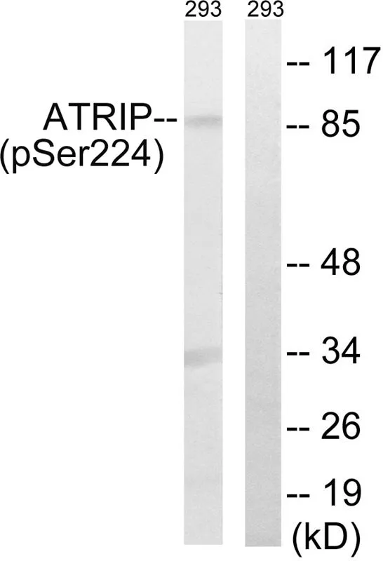 WB analysis of extracts from 293 cells treated with UV (15mins) using GTX55441 ATRIP (phospho Ser224) antibody. Left : Primary antibody Right : Primary antibody pre-incubated with the antigen specific peptide