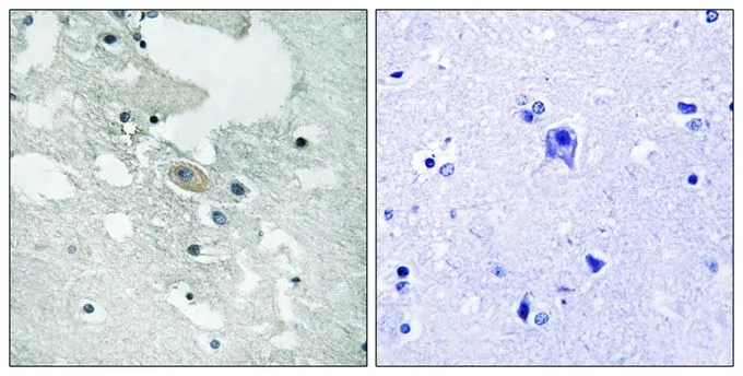 IHC-P analysis of human brain tissue using GTX55443 BLNK (phospho Tyr84) antibody. Left : Primary antibody Right : Primary antibody pre-incubated with the antigen specific peptide IHC-P analysis of human brain tissue using GTX55443 BLNK (phospho Tyr84) antibody. Left : Primary antibody Right : Primary antibody pre-incubated with the antigen specific peptide