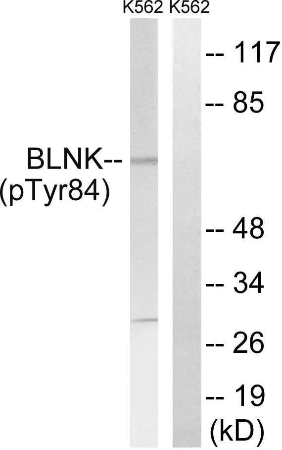 WB analysis of extracts from K562 cells treated with starved (24hours) using GTX55443 BLNK (phospho Tyr84) antibody. Left : Primary antibody Right : Primary antibody pre-incubated with the antigen specific peptide