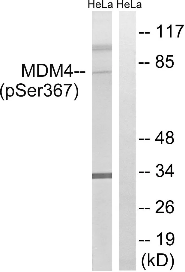 WB analysis of extracts from HeLa cells treated with calyculinA (50ng/ml 30mins) using GTX55445 MDMX (phospho Ser367) antibody. Left : Primary antibody Right : Primary antibody pre-incubated with the antigen specific peptide