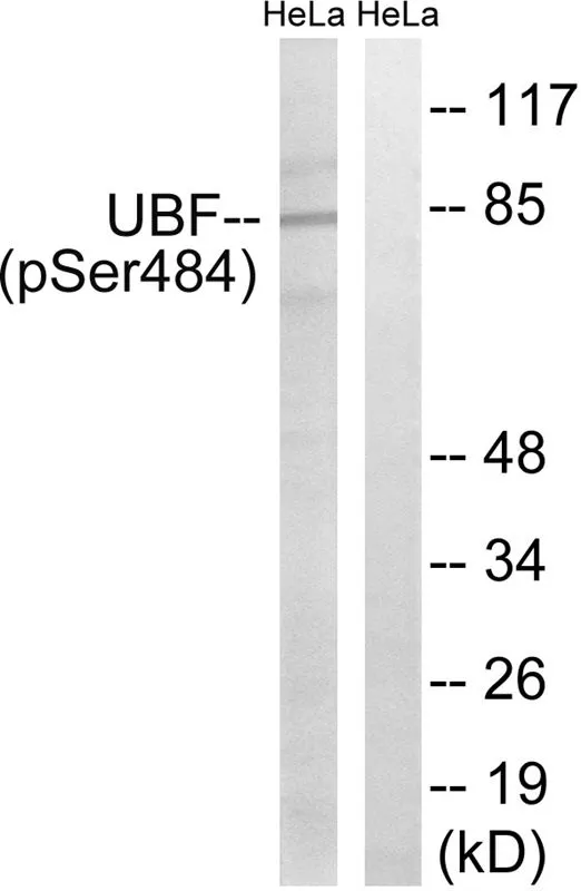 WB analysis of extracts from HeLa cells treated with calyculinA (50ng/ml 30mins) using GTX55450 UBTF (phospho Ser484) antibody. Left : Primary antibody Right : Primary antibody pre-incubated with the antigen specific peptide