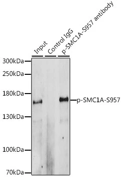 IP analysis of HeLa cell lysate using GTX55474 SMC1 (phospho Ser957) antibody. Antibody amount : 3microg / 200microg lysate Dilution : 1:1000 IP analysis of HeLa cell lysate using GTX55474 SMC1 (phospho Ser957) antibody. Antibody amount : 3microg / 200microg lysate Dilution : 1:1000