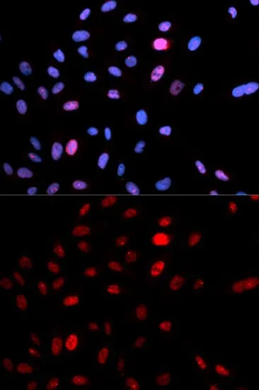 ICC/IF analysis of U2OS cells using GTX55474 SMC1 (phospho Ser957) antibody. Blue : DAPI
