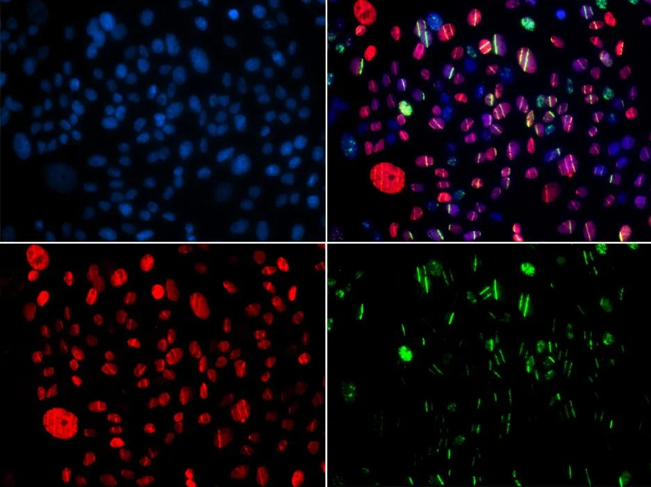 ICC/IF analysis of GFP-RNF168 transgenic U2OS cells using GTX55474 SMC1 (phospho Ser957) antibody. Green : GFP-RNF168 fusion protein expression for DNA damage marker Blue : DAPI